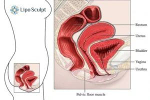 Treatment For A Leaky Bladder 2 How EM Chair treatment Hounslow can help Leaky bladder issues. Read more now!